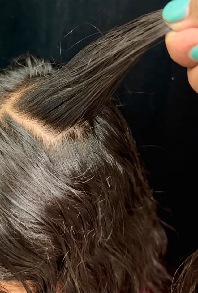 After - Hair Growth Results